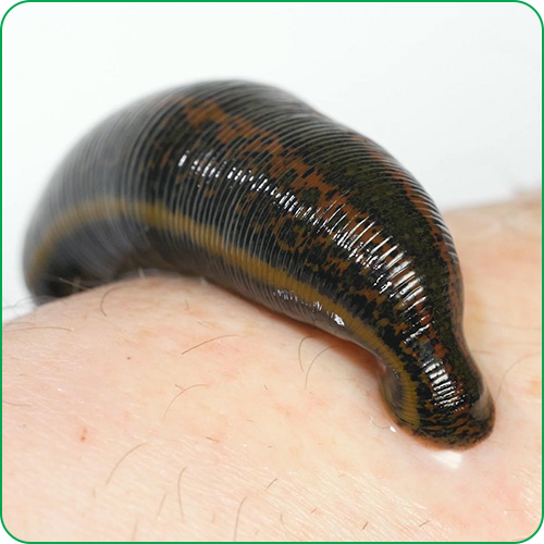 Leech Therapy