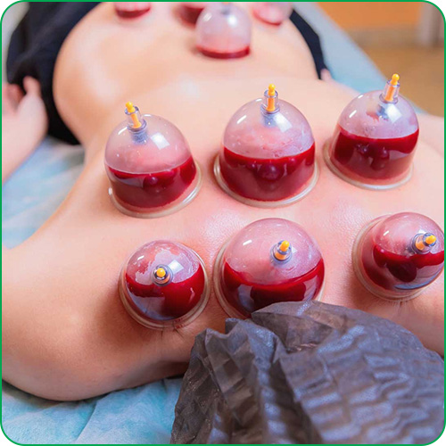 Detox Cupping